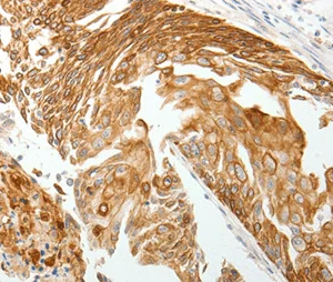 Immunohistochemistry (Formalin/PFA-fixed paraffin-embedded sections) - Anti-Thymosin beta 10 antibody - C-terminal (AB198738)