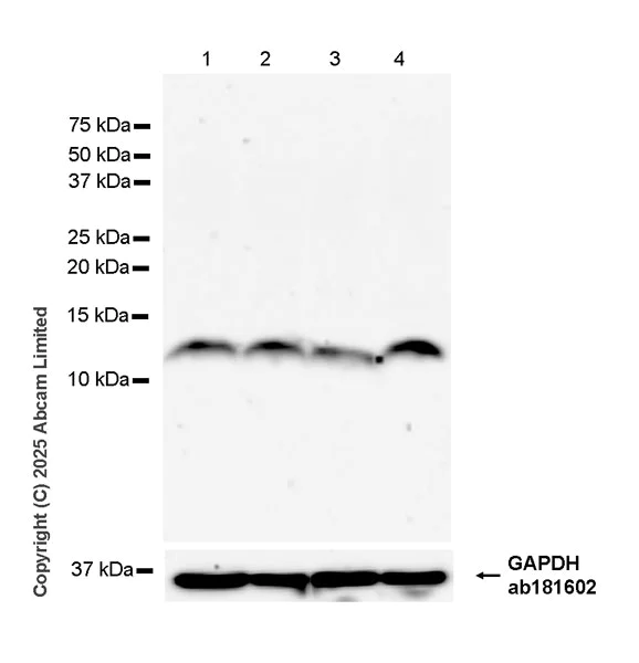 Western blot - Anti-Thymosin beta 4 antibody [EPR26609-45] (AB323478)