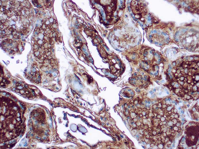 Immunohistochemistry (Formalin/PFA-fixed paraffin-embedded sections) - Anti-Thyroglobulin antibody [1D4] (AB16853), expandable thumbnail