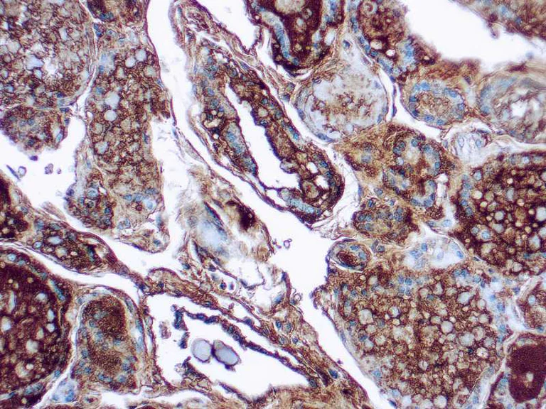 Immunohistochemistry (Formalin/PFA-fixed paraffin-embedded sections) - Anti-Thyroglobulin antibody [1D4] (AB16853)