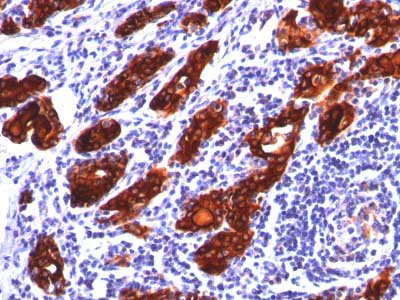 Immunohistochemistry (Formalin/PFA-fixed paraffin-embedded sections) - Anti-Thyroglobulin antibody [2H11] - BSA and Azide free (AB212867), expandable thumbnail
