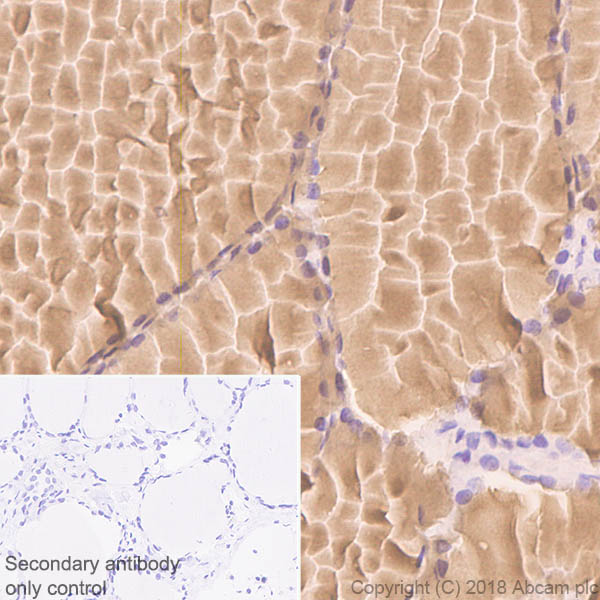 Immunohistochemistry (Formalin/PFA-fixed paraffin-embedded sections) - Anti-Thyroglobulin antibody [CPT-R35.3-31] - BSA and Azide free (AB245205), expandable thumbnail