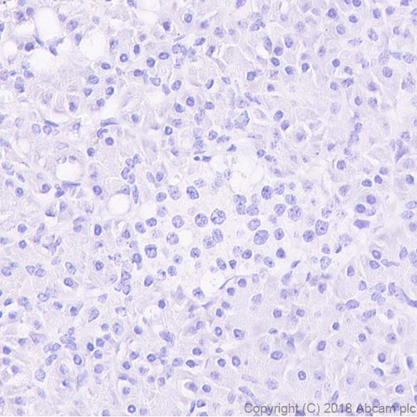 Immunohistochemistry (Formalin/PFA-fixed paraffin-embedded sections) - Anti-Thyroglobulin antibody [CPT-R35.3-31] - BSA and Azide free (AB245205), expandable thumbnail