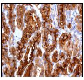 Immunohistochemistry (Formalin/PFA-fixed paraffin-embedded sections) - Anti-Thyroglobulin antibody [EPR3614] (AB92467), expandable thumbnail