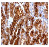 Immunohistochemistry (Formalin/PFA-fixed paraffin-embedded sections) - Anti-Thyroglobulin antibody [EPR3614] (AB92467)