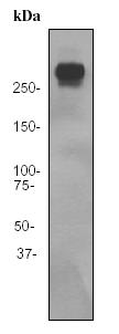 Western blot - Anti-Thyroglobulin antibody [EPR3614] (AB92467), expandable thumbnail