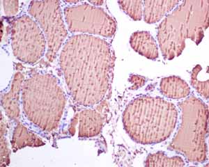 Immunohistochemistry (Formalin/PFA-fixed paraffin-embedded sections) - Anti-Thyroglobulin antibody [EPR3614(2)] (AB151539), expandable thumbnail