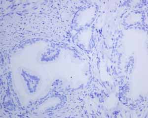 Immunohistochemistry (Formalin/PFA-fixed paraffin-embedded sections) - Anti-Thyroglobulin antibody [EPR3614(2)] (AB151539), expandable thumbnail
