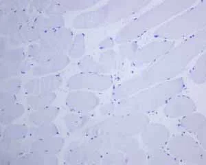 Immunohistochemistry (Formalin/PFA-fixed paraffin-embedded sections) - Anti-Thyroglobulin antibody [EPR3614(2)] (AB151539)