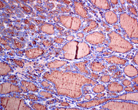 Immunohistochemistry (Formalin/PFA-fixed paraffin-embedded sections) - Anti-Thyroglobulin antibody [EPR3614(2)] (AB151539), expandable thumbnail