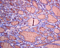 Immunohistochemistry (Formalin/PFA-fixed paraffin-embedded sections) - Anti-Thyroglobulin antibody [EPR3614(2)] (AB151539)