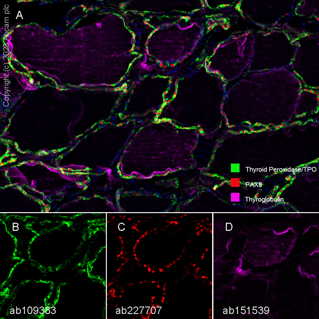 Multiplex immunohistochemistry - Anti-Thyroglobulin antibody [EPR3614(2)] (ab151539), expandable thumbnail