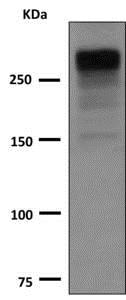 Western blot - Anti-Thyroglobulin antibody [EPR3614(2)] (AB151539), expandable thumbnail