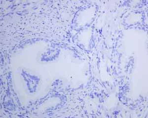 Immunohistochemistry (Formalin/PFA-fixed paraffin-embedded sections) - Anti-Thyroglobulin antibody [EPR3614(2)] - BSA and Azide free (AB248992)