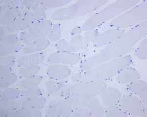 Immunohistochemistry (Formalin/PFA-fixed paraffin-embedded sections) - Anti-Thyroglobulin antibody [EPR3614(2)] - BSA and Azide free (AB248992), expandable thumbnail