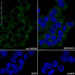 Immunocytochemistry/ Immunofluorescence - Anti-Thyroglobulin antibody [EPR9730] (AB156008), expandable thumbnail