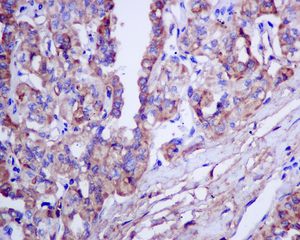 Immunohistochemistry (Formalin/PFA-fixed paraffin-embedded sections) - Anti-Thyroglobulin antibody [EPR9730] (ab156008), expandable thumbnail