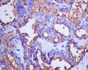 Immunohistochemistry (Formalin/PFA-fixed paraffin-embedded sections) - Anti-Thyroglobulin antibody [EPR9730] (ab156008), expandable thumbnail