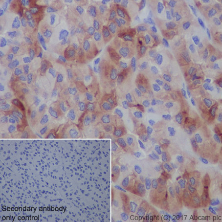 Immunohistochemistry (Formalin/PFA-fixed paraffin-embedded sections) - Anti-Thyroglobulin antibody [EPR9730] (AB156008), expandable thumbnail