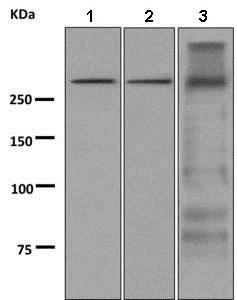 Western blot - Anti-Thyroglobulin antibody [EPR9730] (ab156008), expandable thumbnail