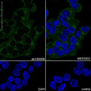 Immunocytochemistry/ Immunofluorescence - Anti-Thyroglobulin antibody [EPR9730] - BSA and Azide free (AB271919)
