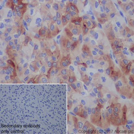 Immunohistochemistry (Formalin/PFA-fixed paraffin-embedded sections) - Anti-Thyroglobulin antibody [EPR9730] - BSA and Azide free (AB271919)