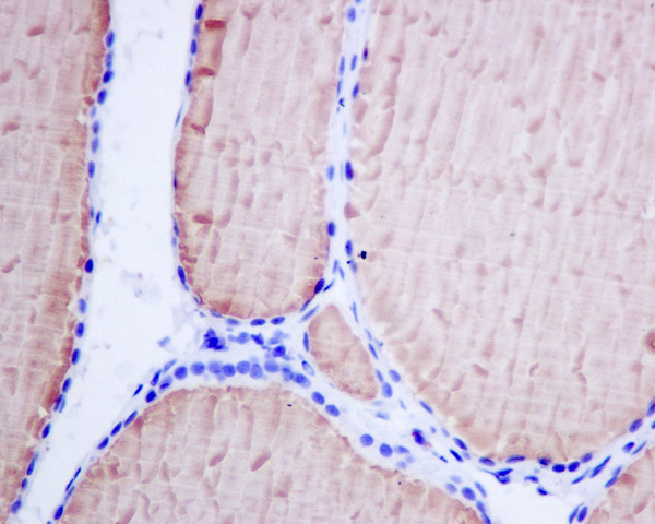 Immunohistochemistry (Formalin/PFA-fixed paraffin-embedded sections) - Anti-Thyroglobulin antibody [EPR9730(IHC)] (AB168344), expandable thumbnail
