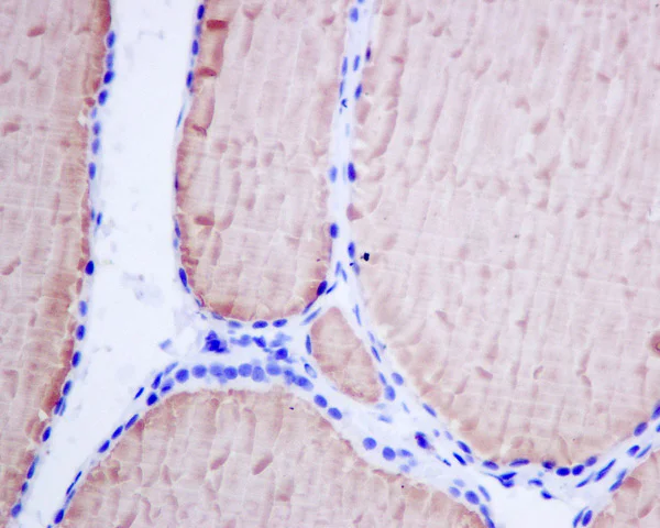 Immunohistochemistry (Formalin/PFA-fixed paraffin-embedded sections) - Anti-Thyroglobulin antibody [EPR9730(IHC)] (AB168344)