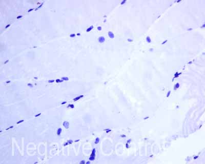 Immunohistochemistry (Formalin/PFA-fixed paraffin-embedded sections) - Anti-Thyroglobulin antibody [EPR9730(IHC)] (AB168344), expandable thumbnail