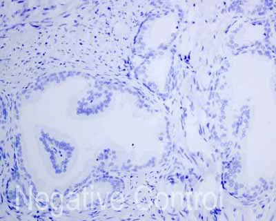 Immunohistochemistry (Formalin/PFA-fixed paraffin-embedded sections) - Anti-Thyroglobulin antibody [EPR9730(IHC)] (AB168344)