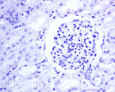 Immunohistochemistry (Formalin/PFA-fixed paraffin-embedded sections) - Anti-Thyroglobulin antibody [EPR9730(IHC)] (AB168344), expandable thumbnail