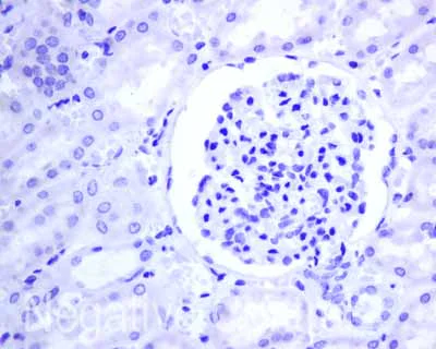 Immunohistochemistry (Formalin/PFA-fixed paraffin-embedded sections) - Anti-Thyroglobulin antibody [EPR9730(IHC)] (AB168344)
