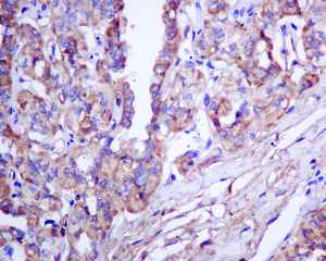 Immunohistochemistry (Formalin/PFA-fixed paraffin-embedded sections) - Anti-Thyroglobulin antibody [EPR9730(IHC)] (AB168344), expandable thumbnail