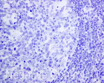 Immunohistochemistry (Formalin/PFA-fixed paraffin-embedded sections) - Anti-Thyroglobulin antibody [EPR9730(IHC)] (AB168344)
