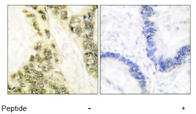 Immunohistochemistry (Formalin/PFA-fixed paraffin-embedded sections) - Anti-Thyroid Hormone Receptor alpha antibody (AB53729), expandable thumbnail