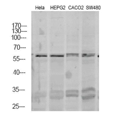 Western blot - Anti-Thyroid Hormone Receptor alpha antibody (AB53729)