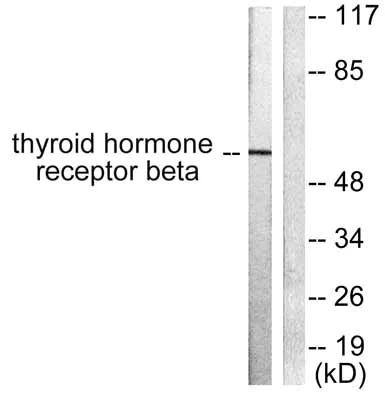 Western blot - Anti-Thyroid Hormone Receptor beta antibody (AB53170)