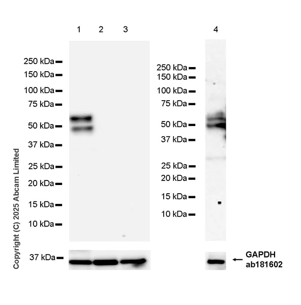Western blot - Anti-Thyroid Hormone Receptor beta antibody [EPR28919-182] (AB324308)
