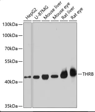 Western blot - Anti-Thyroid Hormone Receptor beta antibody - N-terminal (AB180612)