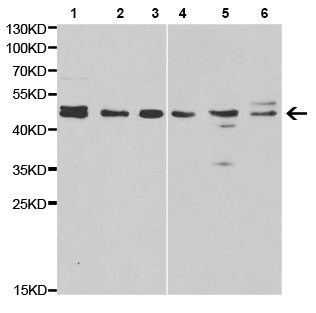 Western blot - Anti-Thyroid Hormone Receptor beta antibody - N-terminal (AB196484)