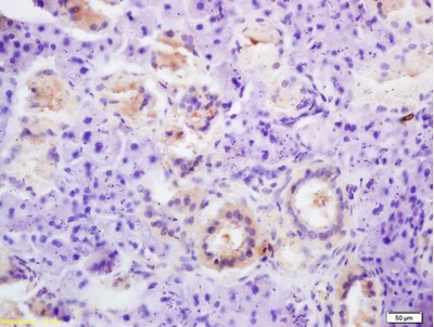 Immunohistochemistry (Formalin/PFA-fixed paraffin-embedded sections) - Anti-Thyroid Peroxidase/TPO antibody (AB203340), expandable thumbnail