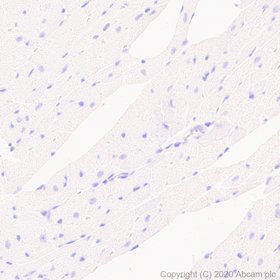 Immunohistochemistry (Formalin/PFA-fixed paraffin-embedded sections) - Anti-Thyroid Peroxidase/TPO antibody [EPR23574-405] (AB278525)