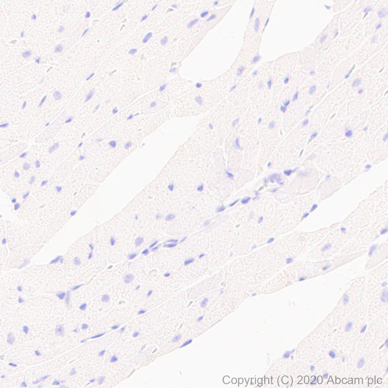Immunohistochemistry (Formalin/PFA-fixed paraffin-embedded sections) - Anti-Thyroid Peroxidase/TPO antibody [EPR23574-405] (AB278525)