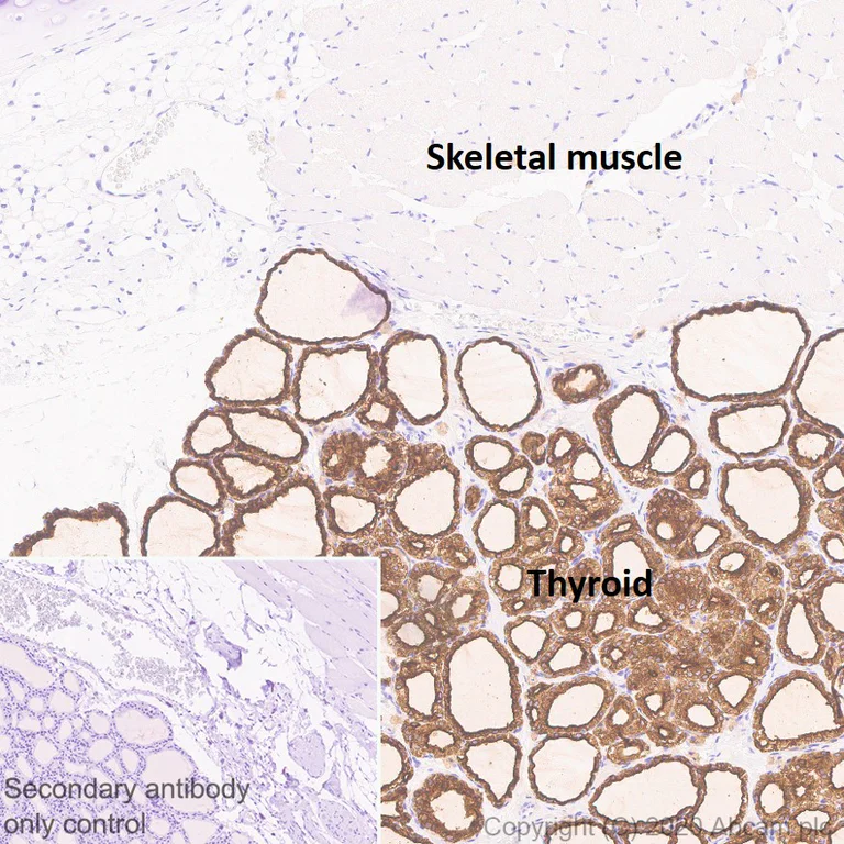 Immunohistochemistry (Formalin/PFA-fixed paraffin-embedded sections) - Anti-Thyroid Peroxidase/TPO antibody [EPR23574-405] - BSA and Azide free (AB278531)