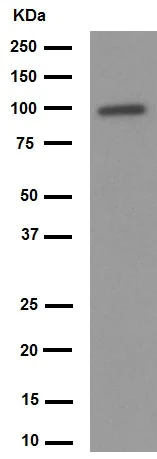 Western blot - Anti-Thyroid Peroxidase/TPO antibody [EPR5379] (AB133322)