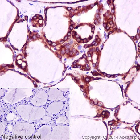 Immunohistochemistry (Formalin/PFA-fixed paraffin-embedded sections) - Anti-Thyroid Peroxidase/TPO antibody [EPR5379] - BSA and Azide free (AB248474)