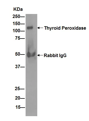 Immunoprecipitation - Anti-Thyroid Peroxidase/TPO antibody [EPR5379] - BSA and Azide free (AB248474)