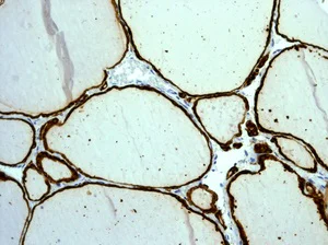 Immunohistochemistry (Formalin/PFA-fixed paraffin-embedded sections) - Anti-Thyroid Peroxidase/TPO antibody [EPR5380] (AB109383)