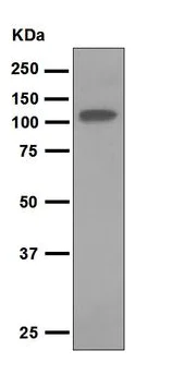 Western blot - Anti-Thyroid Peroxidase/TPO antibody [EPR5380] (AB109383)