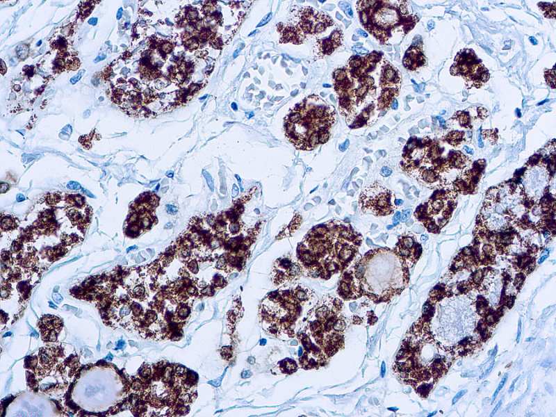 Immunohistochemistry (Formalin/PFA-fixed paraffin-embedded sections) - Anti-Thyroid Peroxidase/TPO antibody [MoAb47] (AB12500)